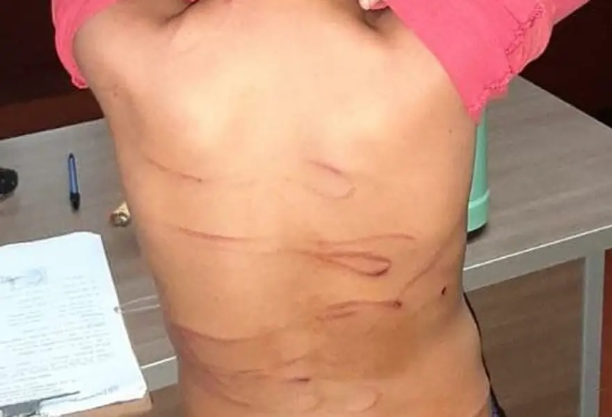 SANTIAGO DEL ESTERO: Azotaba con un cable al hijastro de 5 años y la madre consentía