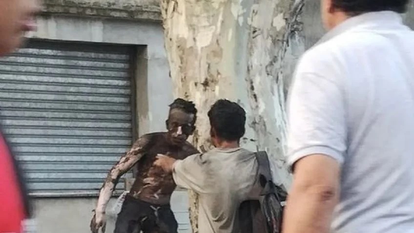 ROSARIO: Murió el joven que tenía el 90% del cuerpo quemado tras sufrir una descarga eléctrica cuando intentaba robar cables