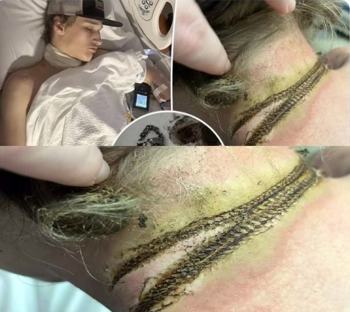 Casi muere a causa de su crucifijo metálico y el cargador de su teléfono