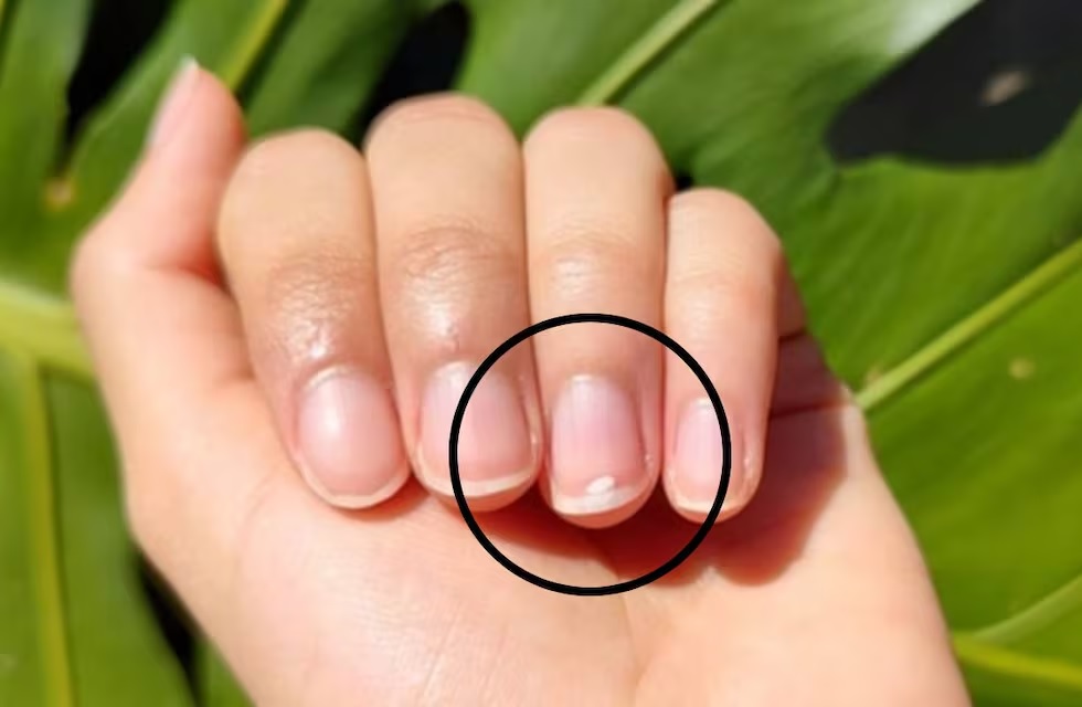 Ni falta de calcio ni de vitaminas: por qué salen manchas blancas en las uñas